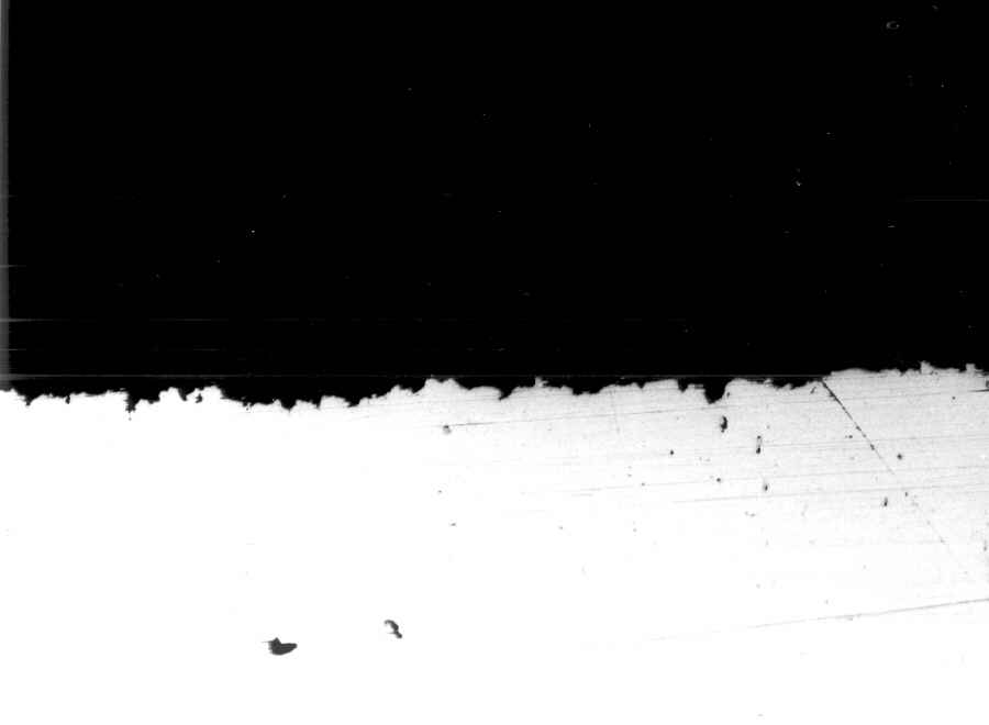 edge of eroded area (magnification: x 200)