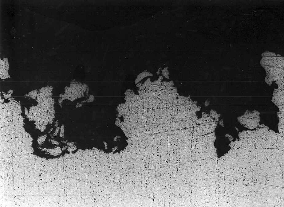 magnification: x 100 (optical microscopy)